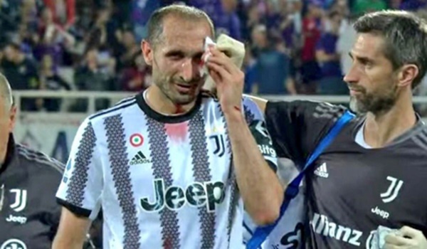 Chiellini đổ máu lần cuối cho Juventus