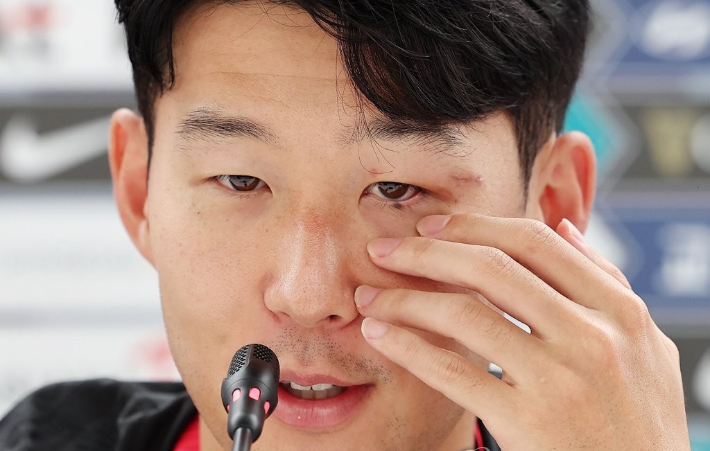 Ảnh bài viết Son Heung-min trông khác lạ khi đeo và tháo mặt nạ