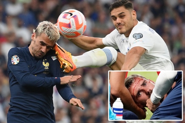 Toàn cảnh cú đạp khiến Griezmann đổ máu