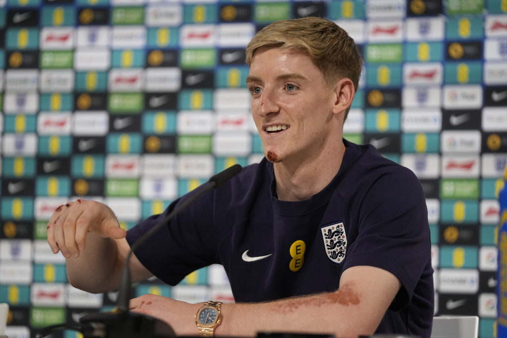 Liverpool nhận cảnh báo vụ Gordon