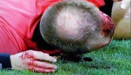 Trọng tài Europa League bị ném vỡ đầu, chảy máu bê bết - Bóng Đá