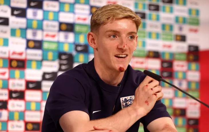 Ảnh bài viết Anthony Gordon đã chỉ cho Liverpool lý do nên chiêu mộ