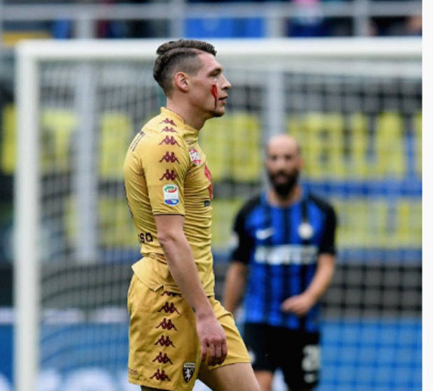 Belotti đổ máu, trong ngày Torino chia điểm với Inter Milan - Bóng Đá