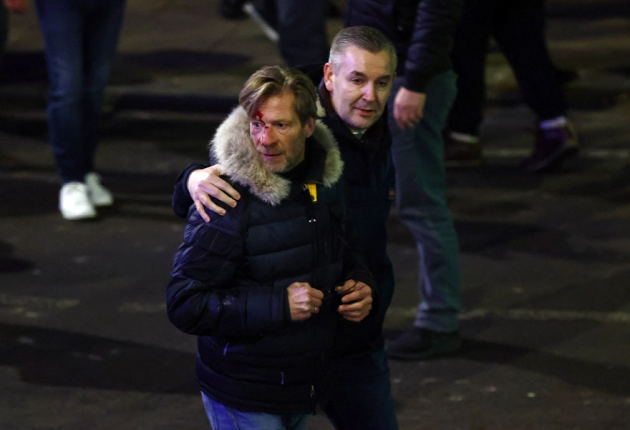 Những cuộc giao tranh được cho là bắt đầu từ nhà ga London cho đến khi nhóm CĐV tiến đến SVĐ. Trên hình là một CĐV bị thương ở đầu sau vụ va chạm.