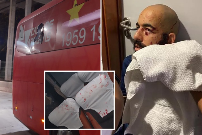 Bomb explodes inside Brazilian team’s bus on way to match as footballer is rushed to hospital with multiple injuries - Bóng Đá