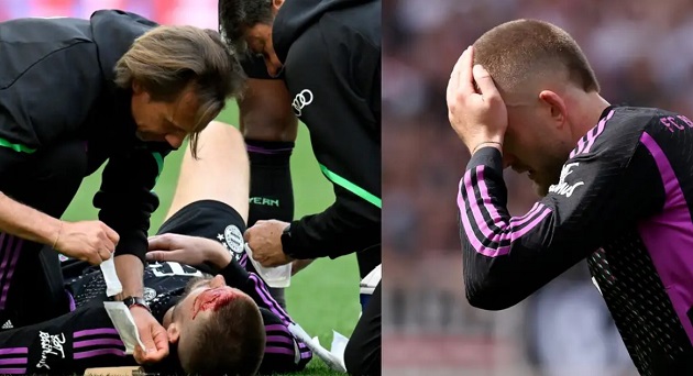 Brave Eric Dier left with blood all over his face as Bayern Munich defender heroically stops Stuttgart scoring but reopens nasty head gash - Bóng Đá