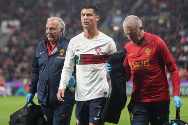 Toàn cảnh sự cố khiến Ronaldo bê bết máu - Bóng Đá
