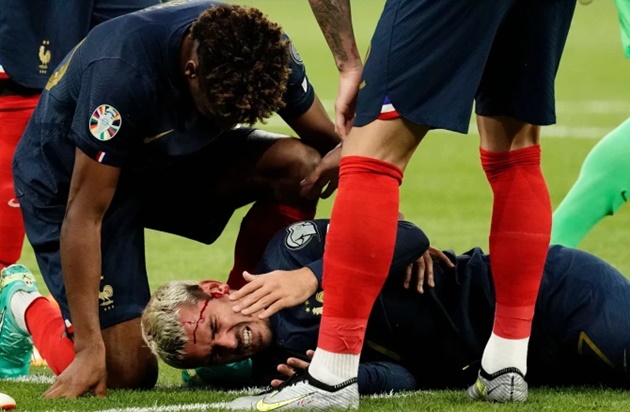 Forgotten ex-Arsenal star leaves Griezmann covered in blood with wild boot to face in France clash - Bóng Đá
