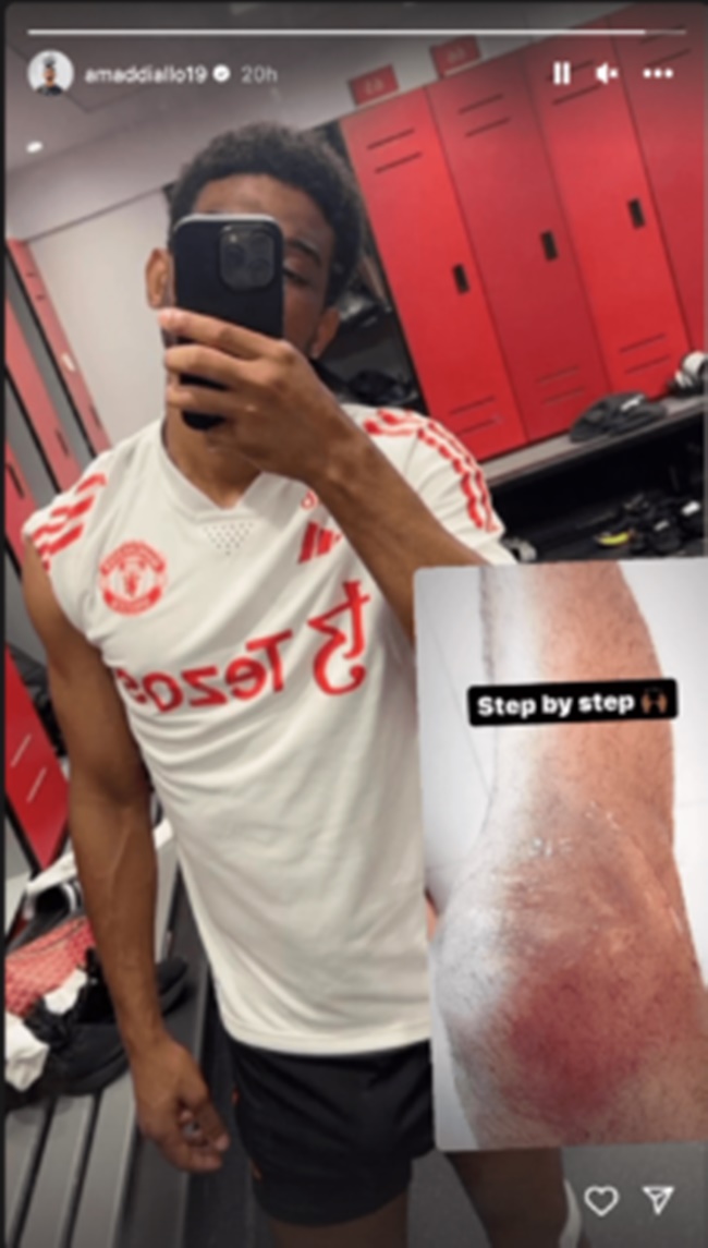 Amad gives latest injury update on Instagram, reveals possible surgery - Bóng Đá
