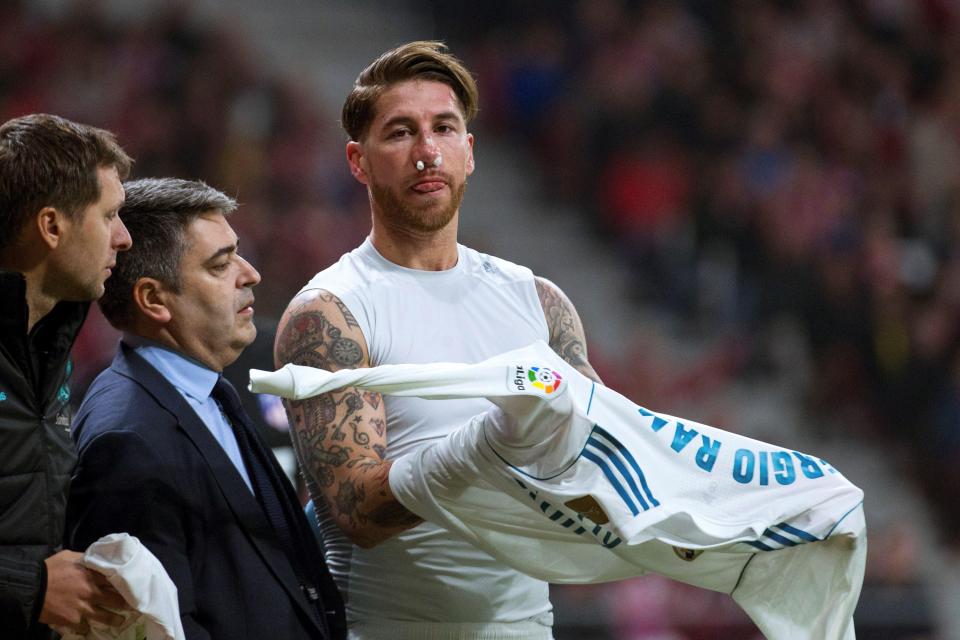 Bị đá vỡ mũi, Sergio Ramos phản ứng ra sao? - Bóng Đá