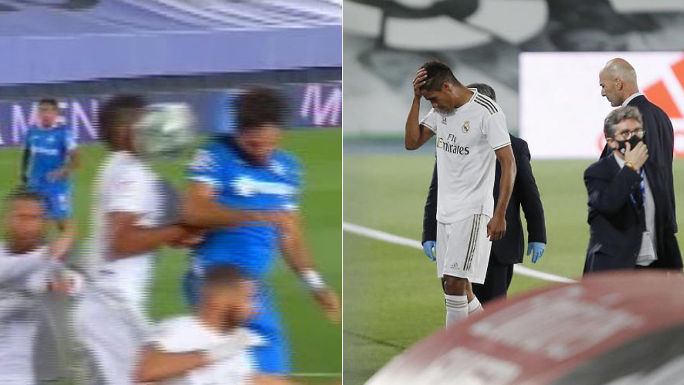 Varane forced off after being hit in the face with the ball - Bóng Đá