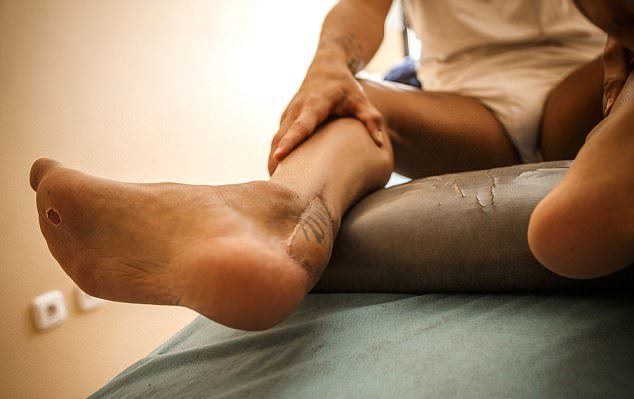 Cận cảnh chấn thương gân bàn chân ghê rợn của Santi Cazorla - Bóng Đá