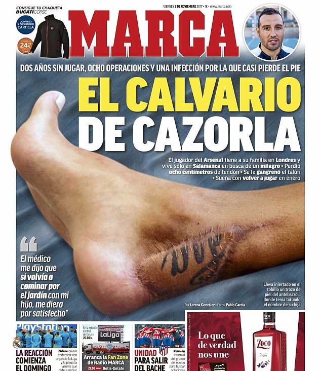 Cận cảnh chấn thương gân bàn chân ghê rợn của Santi Cazorla - Bóng Đá