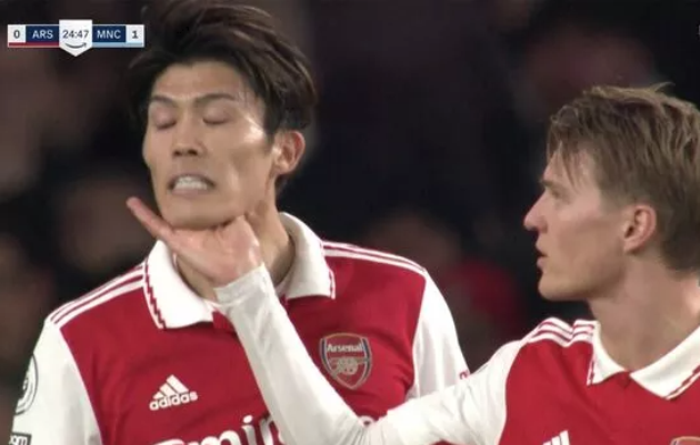 Arsenal star Odegaard's reaction to Tomiyasu mistake vs Man City speaks volumes - Bóng Đá