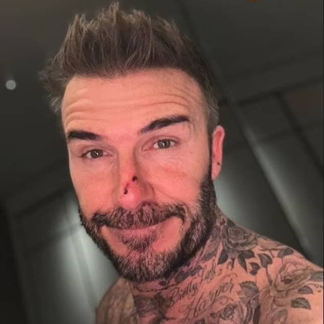 'Don't put your nose near your daughter's mouth': David Beckham reveals bloodied face after Harper, 10, bit him while he tickled her - Bóng Đá