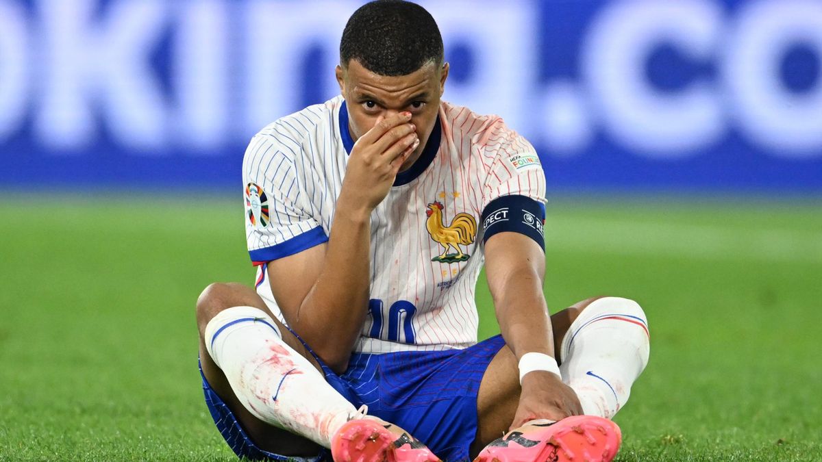 NÓNG! Đã có kết quả vụ Mbappe vỡ mũi, rõ khả năng rời EURO sớm
