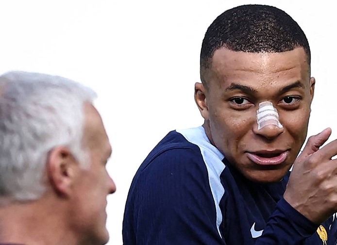 Lộ hình ảnh đầu tiên của Mbappe sau khi gãy mũi