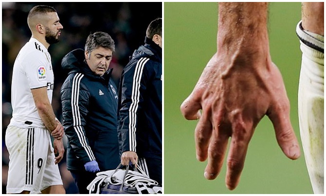 Thua đau nhược tiểu, Real Madrid còn gặp tổn thất nghiêm trọng - Bóng Đá
