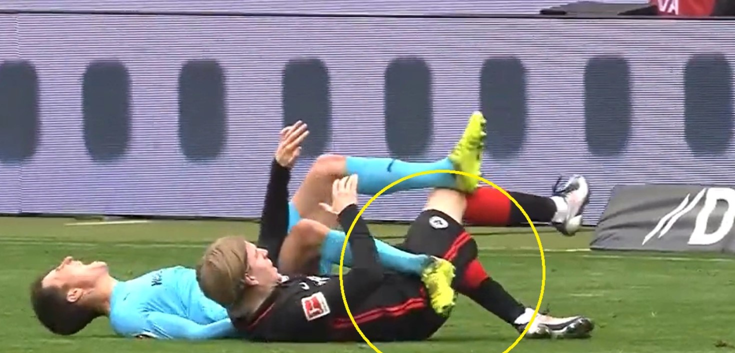 Cầu thủ Bundesliga gãy chân sau pha va chạm - Bóng Đá