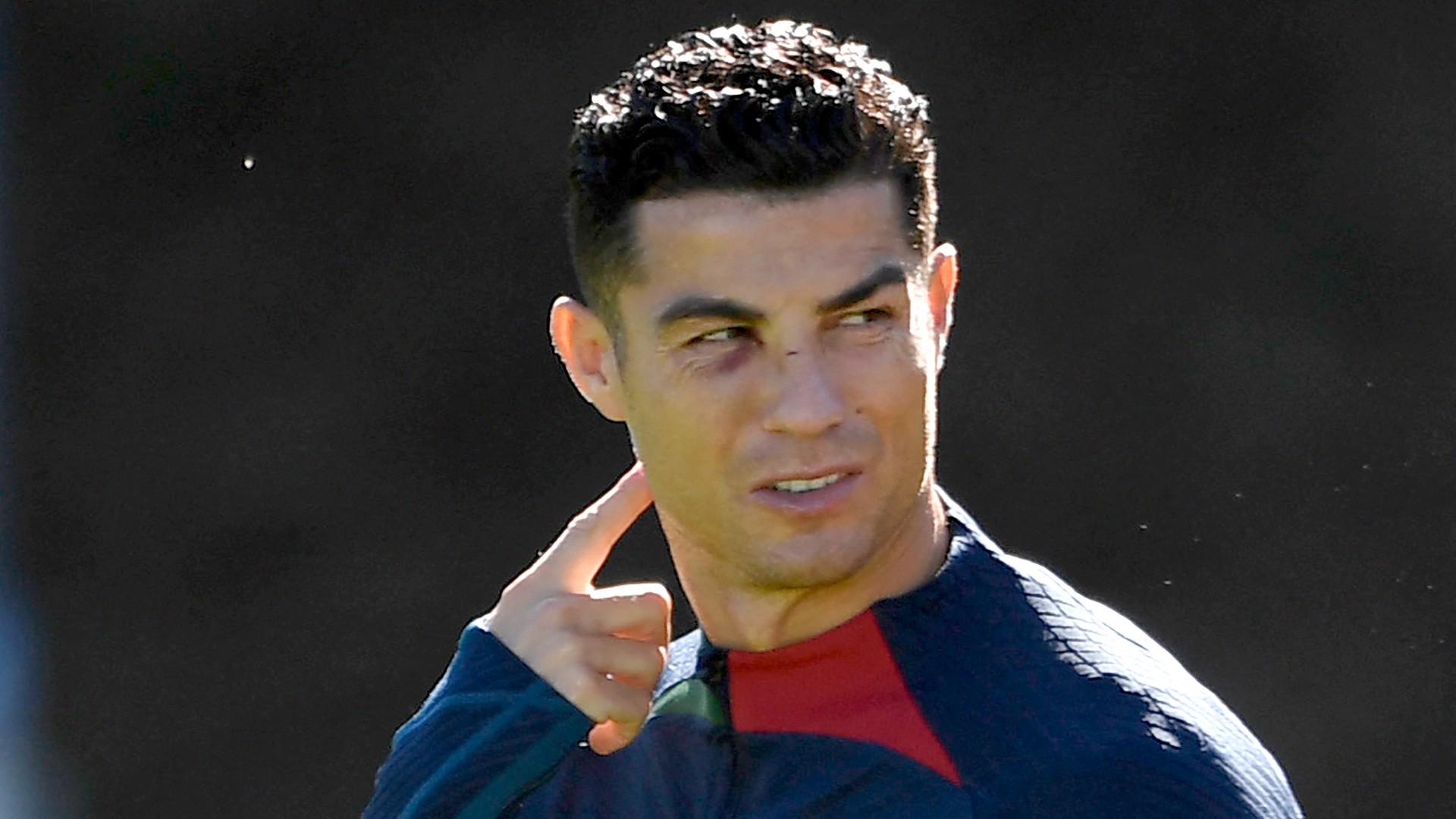Ronaldo đến sân tập với khuôn mặt bầm tím - Bóng Đá