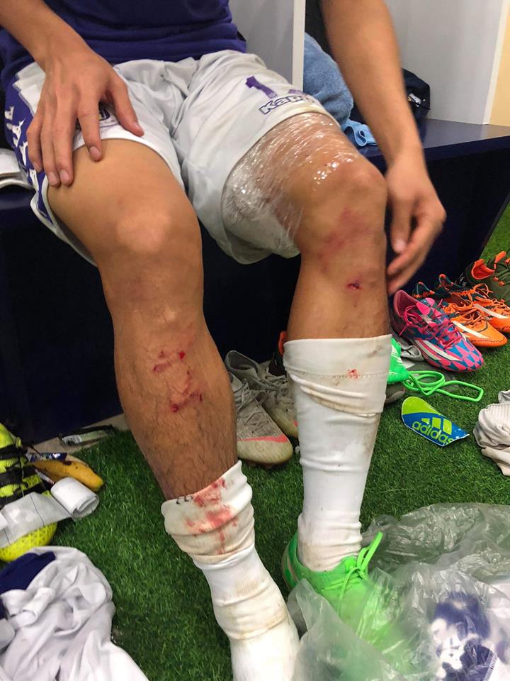 Ảnh bài viết Quế Ngọc Hải vào bóng thô bạo bằng hai chân với Văn Kiên