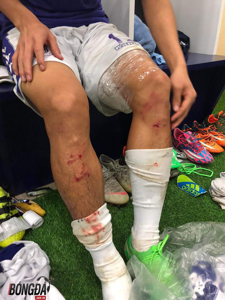 Ảnh bài viết Suýt “phang” gãy chân đồng nghiệp, HLV Viettel vẫn khen ngợi Quế Ngọc Hải