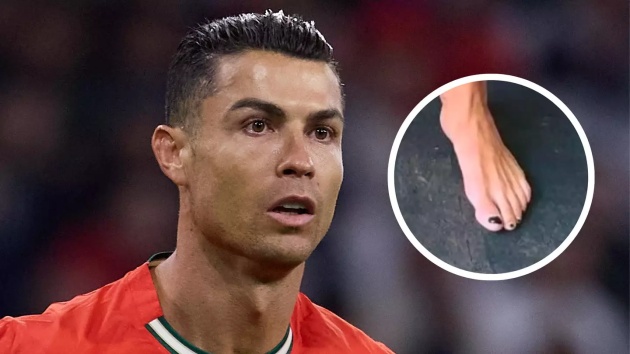 Chiến lược khôn ngoan! Lý do Ronaldo sơn móng chân màu đen