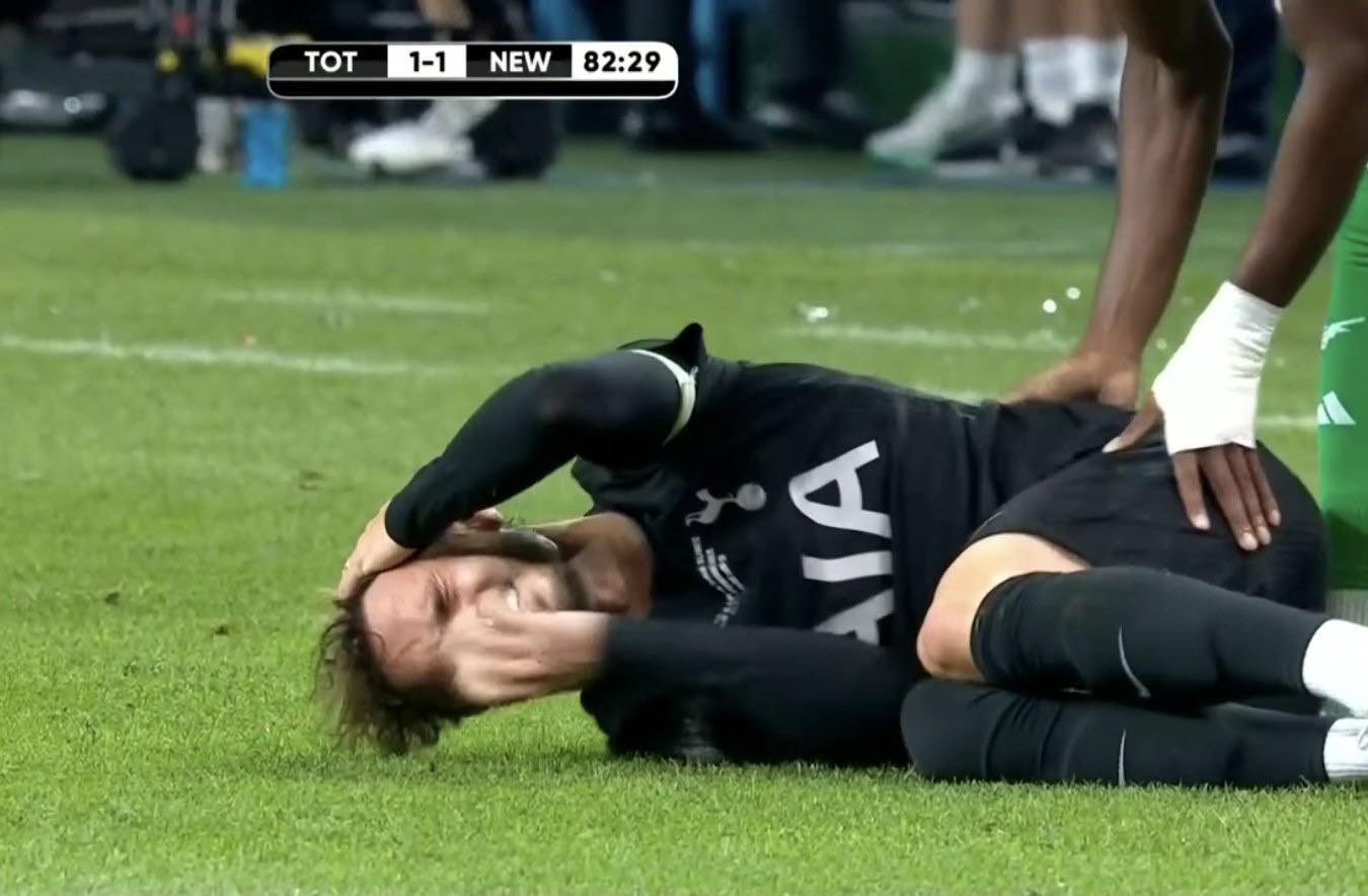 Biểu cảm của James Maddison khi ngã xuống sân.