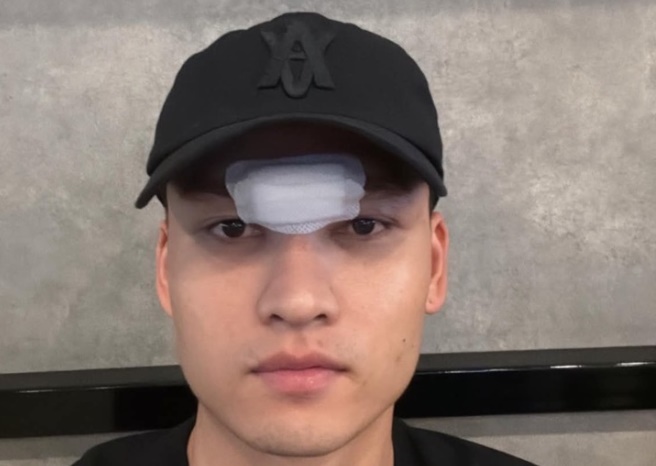 Việt Anh khâu 14 mũi sau pha va chạm ở trận đấu vừa qua.