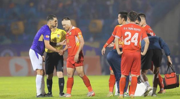 Ảnh bài viết Trọng Hoàng suýt đứt tai sau pha va chạm mạnh với Hoàng Hên