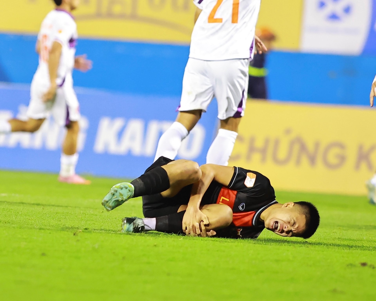 Ảnh bài viết Sao Việt Kiều chấn thương, HLV Albadalejo phẫn nộ