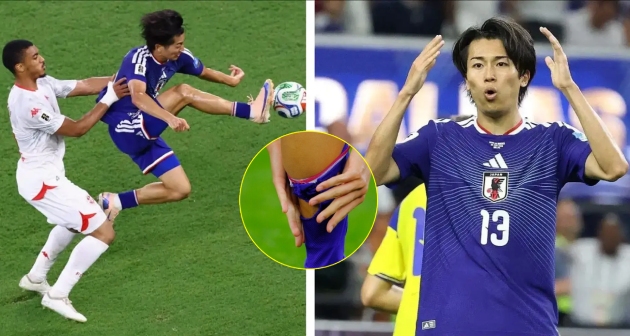 Keito Nakamura gây tranh cãi ở World Cup 2026 với tất khoét lỗ. Ảnh: Footy Headlines Getty Images.