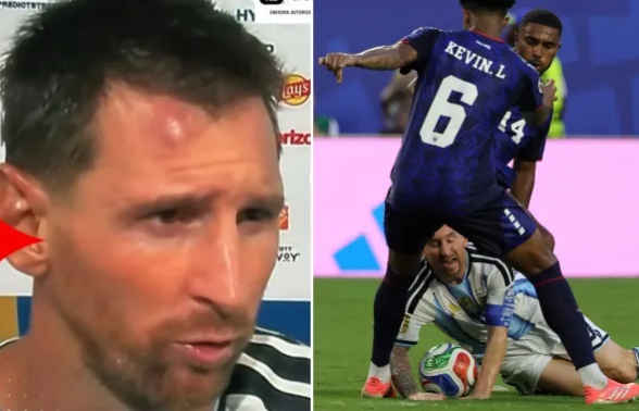 Messi dính chấn thương vùng đầu. Ảnh: The Sun.