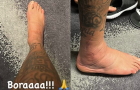 Neymar đăng ảnh kinh dị về chấn thương