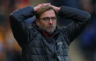 3 hợp đồng thất bại của Klopp tại Liverpool