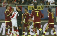 Thêm một thẻ đỏ ngớ ngẩn tại Copa America 2015