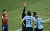 Cavani bị đuổi, Uruguay thành cựu vương Copa America