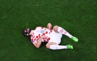 Croatia mất oan quả penalty?