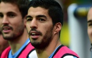 Đối đầu Venezuela, Uruguay vẫn chưa thể 'cậy nhờ' Suarez