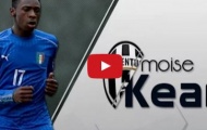 Tài năng đặc biệt của Moise Kean (Juventus)