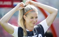 Gương mặt khả ái nàng tuyển thủ quốc gia tuyển Hà Lan