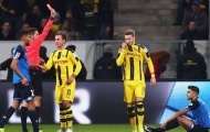 HLV Dortmund chưa hết bức xúc vì Marco Reus