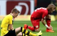 XÁC NHẬN: Marco Reus lại khiến fan Dortmund sầu lòng