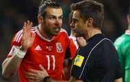 Bale, Sanchez và những ngôi sao có khả năng không thể dự World Cup