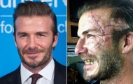 Xót xa với nhan sắc 'xấu tệ' của Beckham trong phim mới