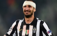 Giorgio Chiellini - Trung vệ thép của Juventus và đội tuyển Italia
