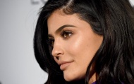 Đôi môi cong đầy gợi cảm của Kylie Jenner
