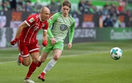 Từ FIFA 18, đâu là đội hình trẻ tiềm năng nhất của Bundesliga? (Phần 1)