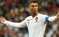 Tại sao Ronaldo luôn mặc áo dài tay khi thi đấu?