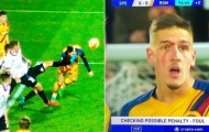 Học trò Mourinho trưng bộ mặt bầm dập sau chiến thắng nghẹt thở